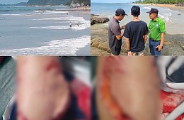 В Таиланде туриста кто-то искусал в море: подозревают нападение акулы